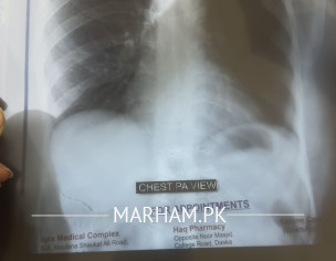 Cough For A Long Time 