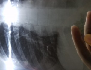 Xray Report