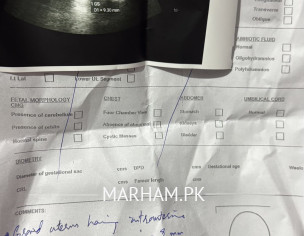 For Medical Abortion