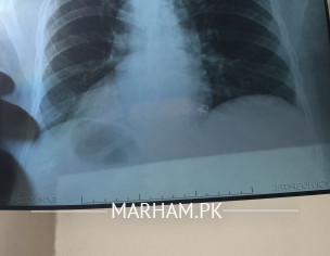 X Ray Report Check 