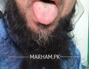 معدہ کا مسلہ