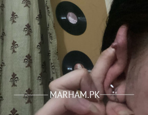 Ear Piercing Infection 