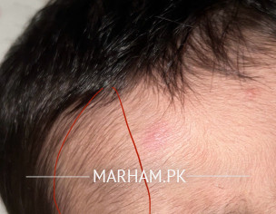 Fall From Lap On Floor 