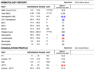 Tonsillitis And Enlarged Adenoids