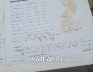 Please Check My Test