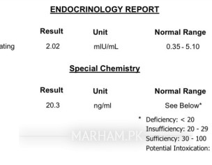 Migraine And Weakness