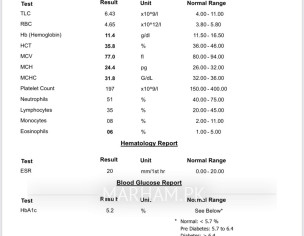 Migraine And Weakness