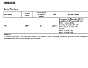 Hyperthyroidism And Hypothyroidism