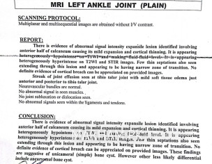 Left Ankle Joint 