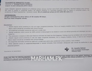 Nursery For New Born. 