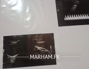 Nursery For New Born. 