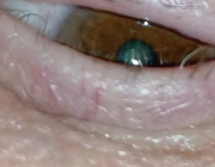 Eye Problem Things N Eye