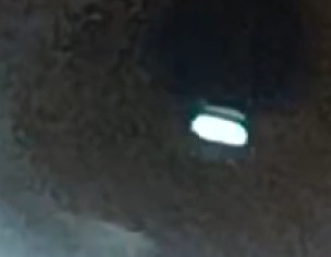 Eye Problem Things N Eye