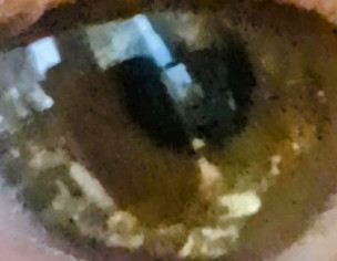 Eye Problem Things N Eye