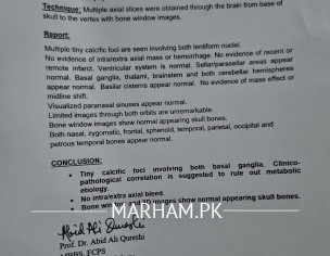 Having Problem In Walking