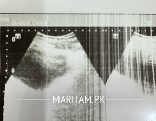 Pregnancy 2nd Opinion