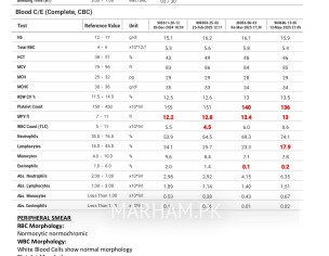 Slightly Low Platelets