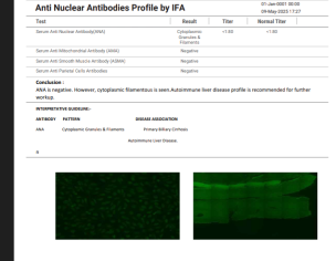 Interstitial Lung Disease