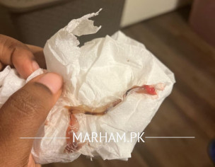 Discharge And Period