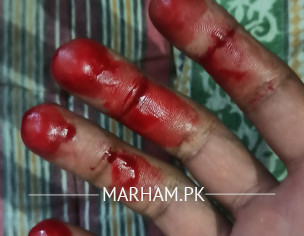 Don't Know About Problem.