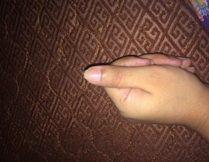 Skin Around Nail