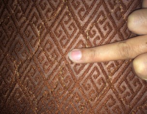 Skin Around Nail