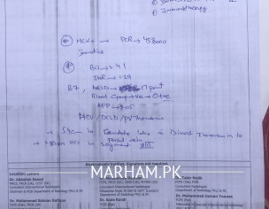 Hepatocellular Carcinoma 