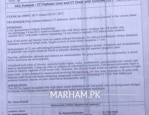 Hepatocellular Carcinoma 