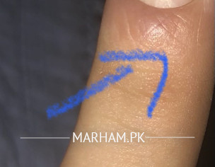 Dermatologist Special 