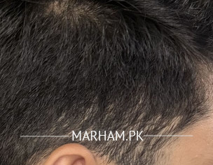 SKIN PROBLEM ON HEAD AND FACE