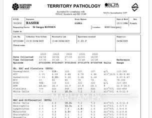 Cbc Test