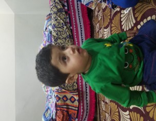 Little Milestone(muscle Weakness)