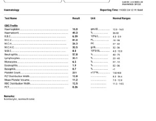 Weight Gaining Issues
