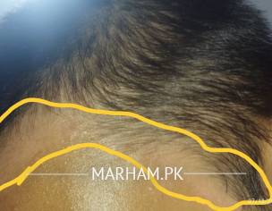 Skin Issues., Psoriasis Etc