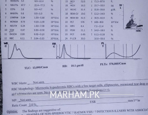 BETA THALASSAEMIA TRAIT.