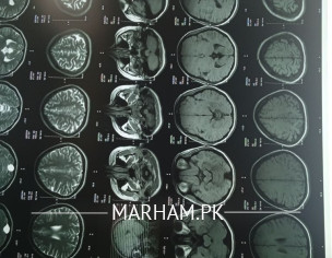 Open MRI BRAIN