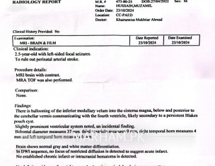 Epilepsy In Sleep On Left Side Only 