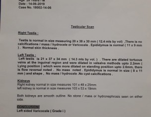 Left Sided Verocele Grade 1