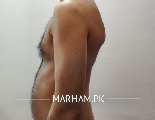 Body Posture Distrube