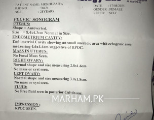 Blighted Ovum Pregnancy 