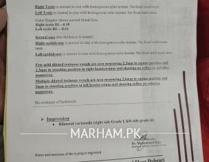 Bilateral Varecocele Issue