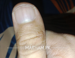 Thumbnails Light Black Lines