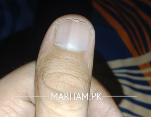 Light Black Lines On Both Thumbnails