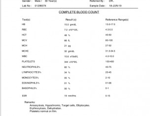 Vitamin D And Testosterone Deficiency 