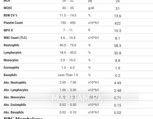 Random Bruising And Red Dots