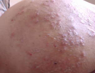 Backside Some Fungus 