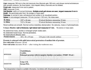 PSA Test (Urologist Advice Requested)