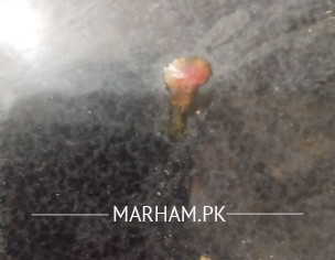 Incomplete Evacuation And Thin Stools