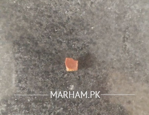 Incomplete Evacuation And Thin Stools