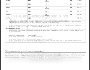 Multiple Myeloma With Ckd 5